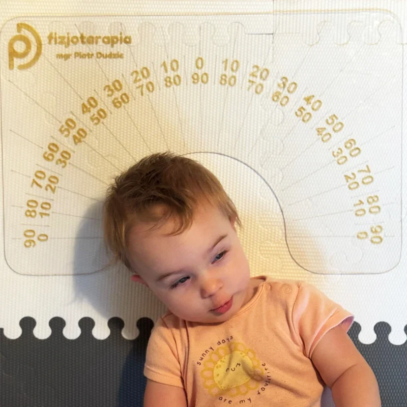 Goniometr pediatryczny - precyzyjne pomiary u niemowląt