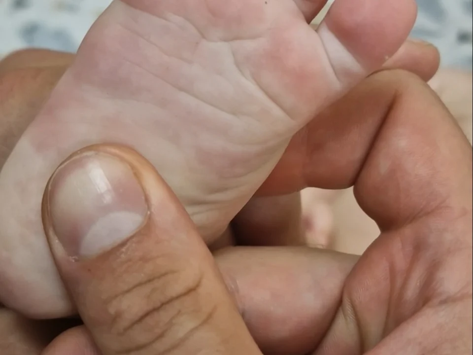 rozwój stóp u niemowląt